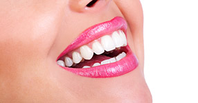 Dişeti Estetiği (Gummy Smile)